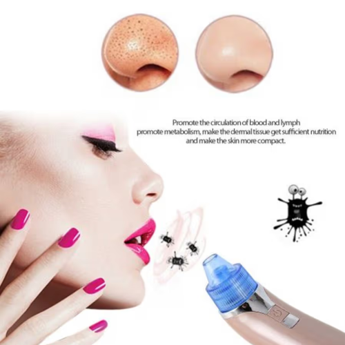 Vacuum Pressure Ance Pore Cleaning Tool